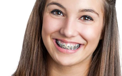 Braces for Teens in Muskogee, OK